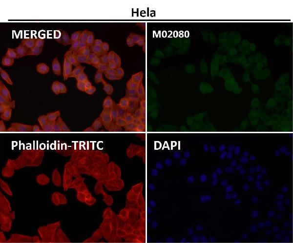 1 - Anti-SMYD3 Monoclonal Antibody ABO14571
