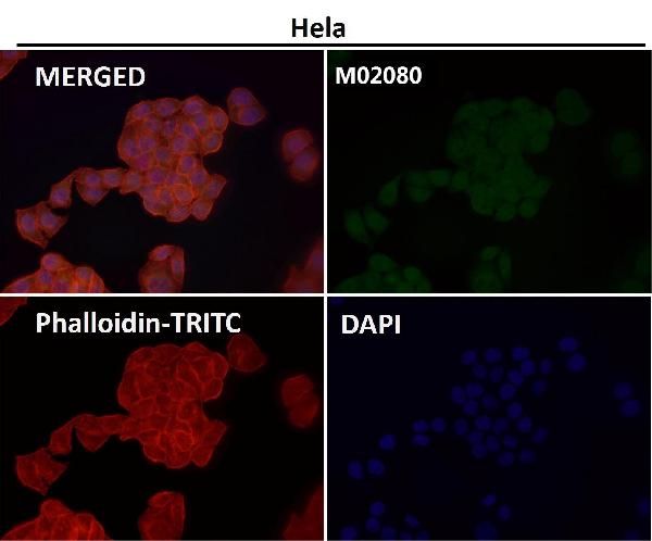 1 - Anti-SMYD3 Monoclonal Antibody ABO14571
