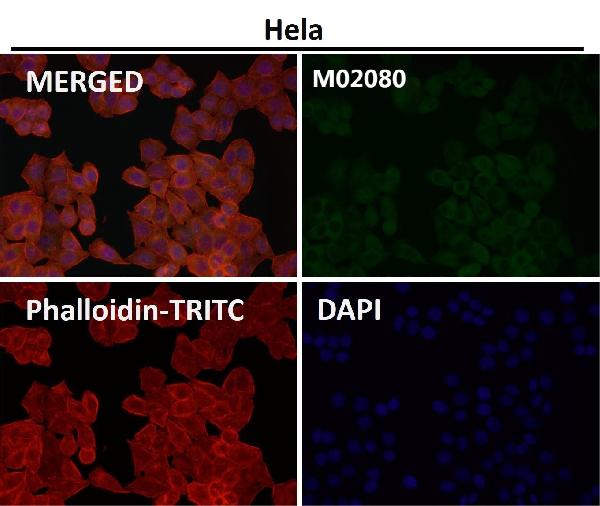 1 - Anti-SMYD3 Monoclonal Antibody ABO14571