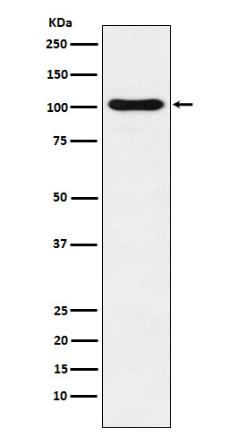 1 - Anti-DNA Ligase IV Rabbit Monoclonal Antibody ABO14573