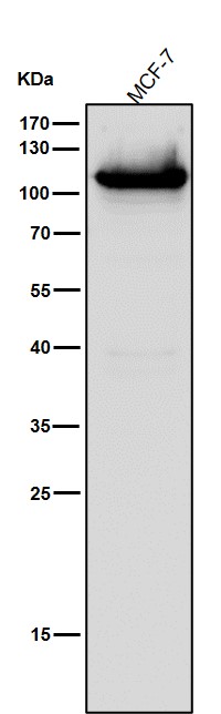1 - Anti-DNA Ligase IV Rabbit Monoclonal Antibody ABO14573