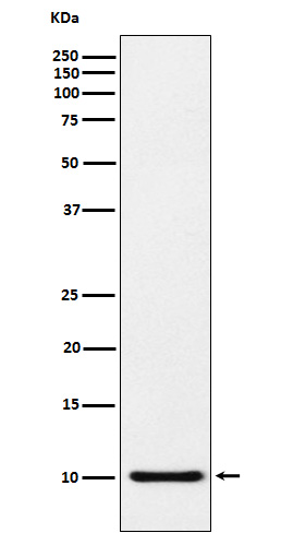 1 - Anti-RANTES CCL5 Monoclonal Antibody ABO14574