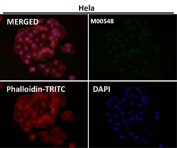 1 - Anti-ZEB1 Monoclonal Antibody ABO14576