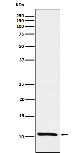 1 - Anti-Estrogen Inducible Protein pS2 Monoclonal Antibody ABO14578
