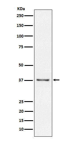 1 - Anti-CD23 FCER2 Monoclonal Antibody ABO14579