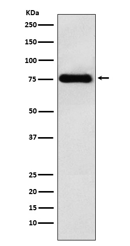 1 - Anti-LYRIC Monoclonal Antibody ABO14582