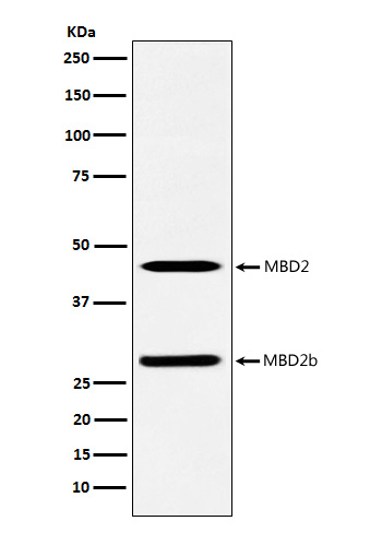 1 - Anti-MBD2 Rabbit Monoclonal Antibody ABO14584