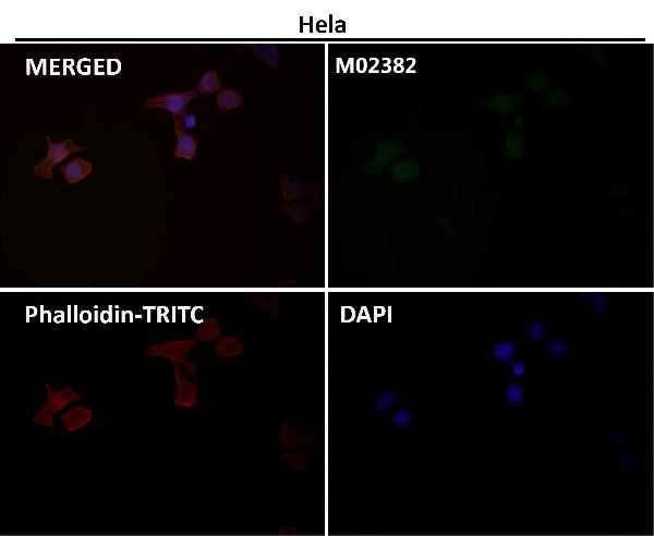 1 - Anti-PFKFB3 Monoclonal Antibody ABO14585