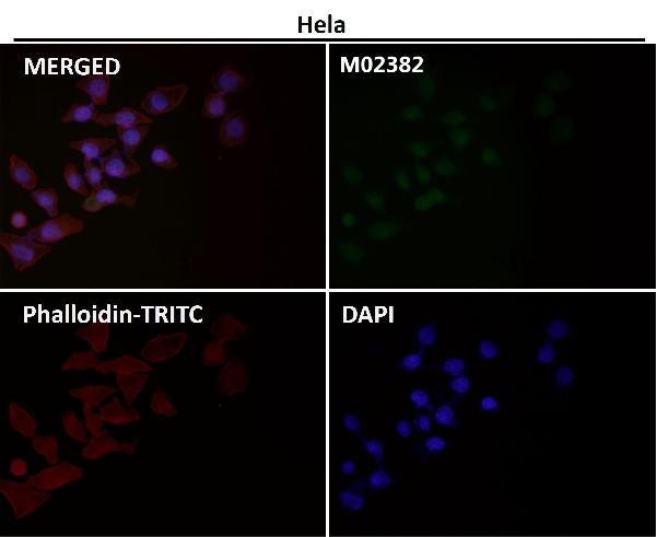 1 - Anti-PFKFB3 Monoclonal Antibody ABO14585