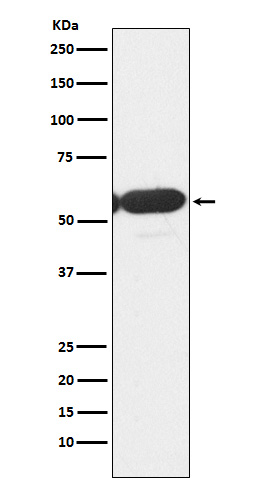 1 - Anti-PFKFB3 Monoclonal Antibody ABO14585