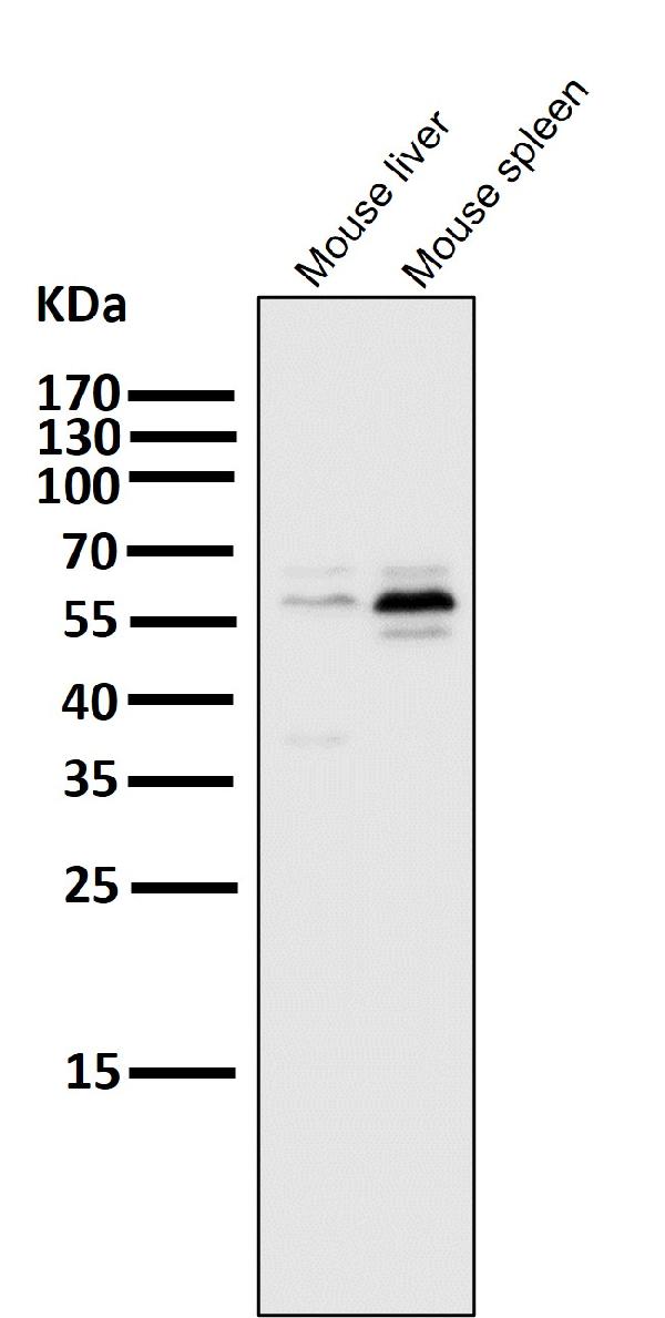 1 - Anti-PFKFB3 Monoclonal Antibody ABO14585