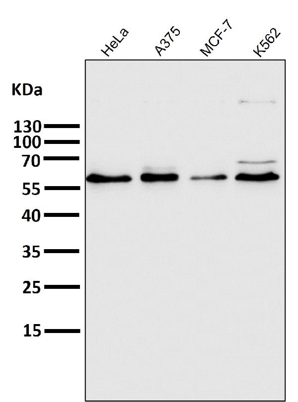 1 - Anti-PFKFB3 Monoclonal Antibody ABO14585