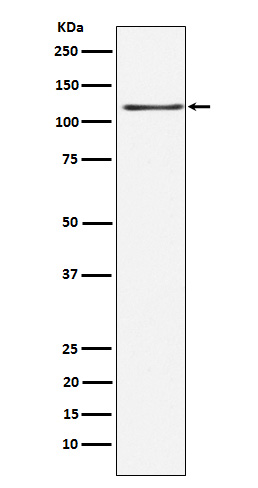 1 - Anti-KSR1 Rabbit Monoclonal Antibody ABO14586