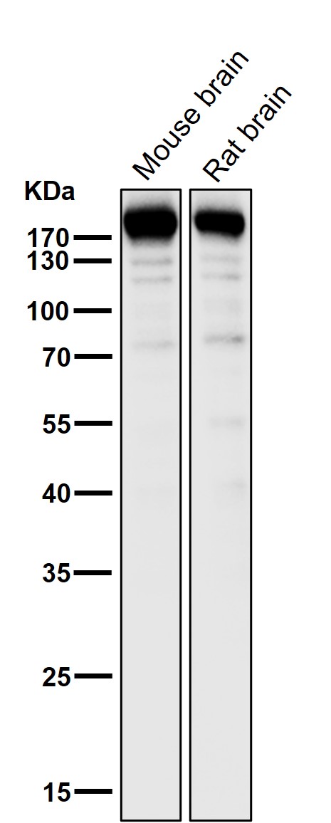 1 - Anti-SynGAP Rabbit Monoclonal Antibody ABO14589