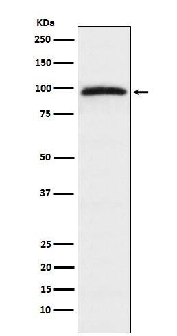 1 - Anti-Epac1 Rabbit Monoclonal Antibody ABO14594