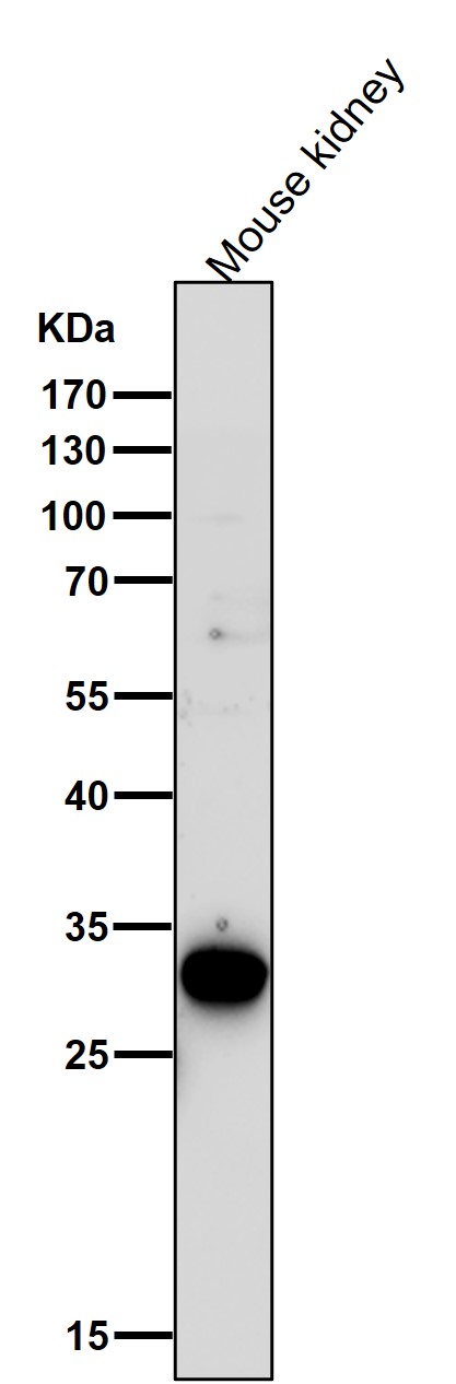 1 - Anti-GCLM Monoclonal Antibody ABO14595