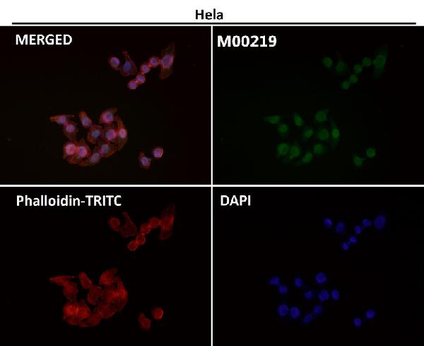1 - Anti-FTO Monoclonal Antibody ABO14598