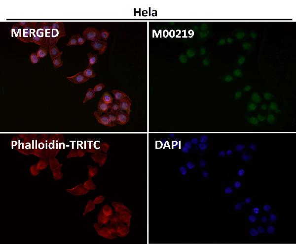 1 - Anti-FTO Monoclonal Antibody ABO14598