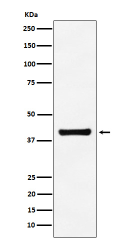 1 - Anti-Aldolase ALDOA Monoclonal Antibody ABO14599