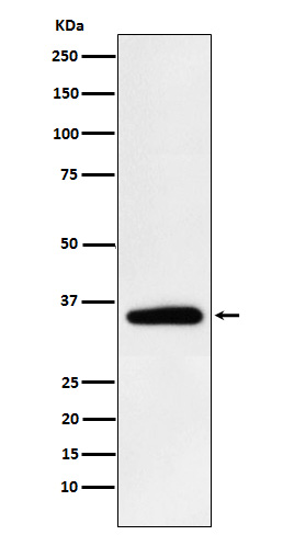 1 - Anti-Pyruvate Dehydrogenase E1 beta subunit PDHB Monoclonal Antibody ABO14601