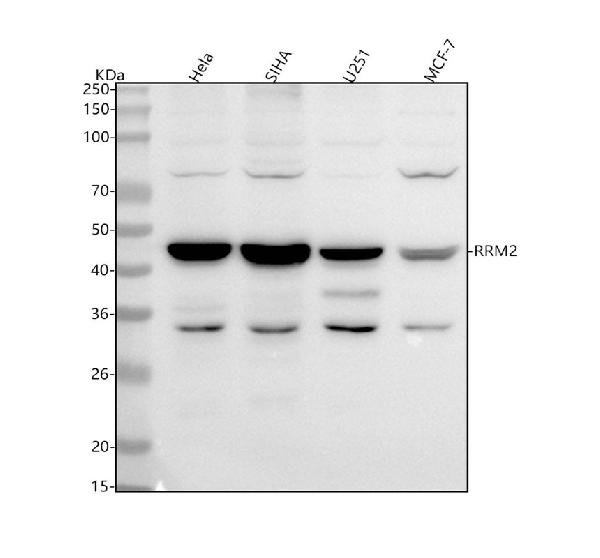 1 - Anti-RRM2 Monoclonal Antibody ABO14602