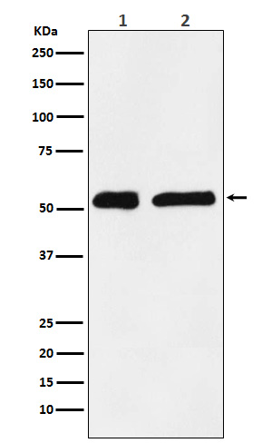 1 - Anti-KPNA2 Monoclonal Antibody ABO14603