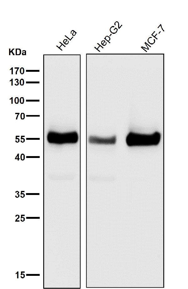 1 - Anti-TXNIP Monoclonal Antibody ABO14608