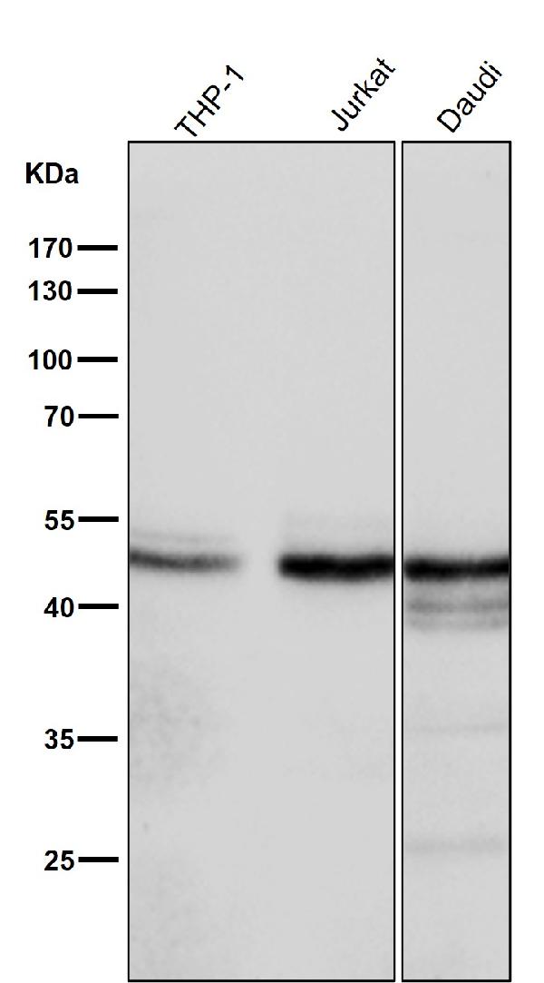 1 - Anti-TXNIP Monoclonal Antibody ABO14608