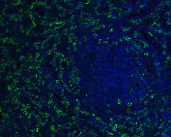 3 - Anti-Iba1 AIF1 Monoclonal Antibody ABO14609