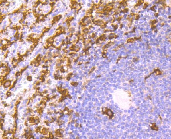 2 - Anti-Iba1 AIF1 Monoclonal Antibody ABO14609