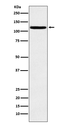 1 - Anti-HAUSP / USP7 Rabbit Monoclonal Antibody ABO14610