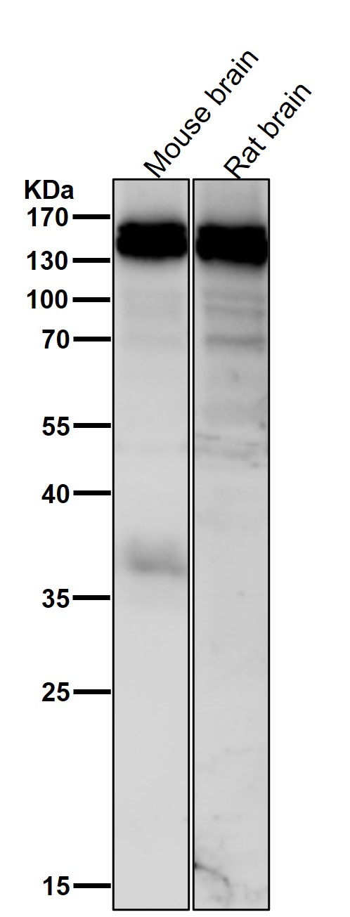 1 - Anti-HAUSP / USP7 Rabbit Monoclonal Antibody ABO14610
