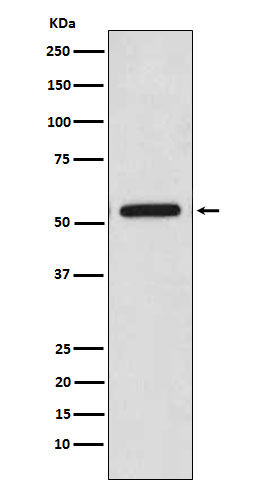 1 - Anti-CaMKII Monoclonal Antibody ABO14617