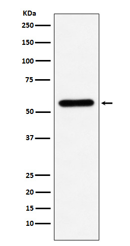 1 - Anti-Liver Carboxylesterase 1 Monoclonal Antibody ABO14619