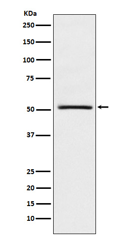 1 - Anti-NR0B1 / DAX1 Monoclonal Antibody ABO14620