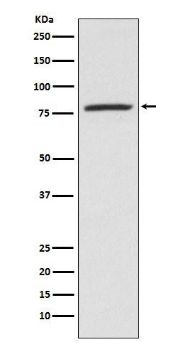 1 - Anti-5 Lipoxygenase ALOX5 Monoclonal Antibody ABO14622