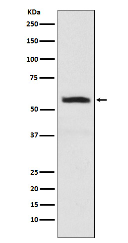 1 - Anti-alpha Internexin INA Monoclonal Antibody ABO14624