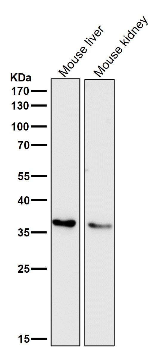1 - Anti-IGFBP7 Monoclonal Antibody ABO14627