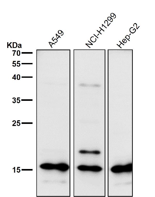 1 - Anti-Uteroglobin SCGB1A1 Monoclonal Antibody ABO14628