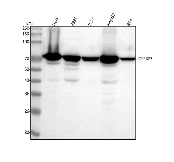 1 - Anti-IMP3 IGF2BP3 Monoclonal Antibody ABO14629