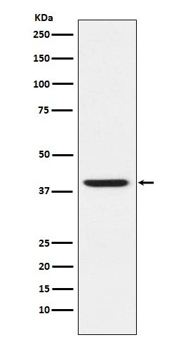 1 - Anti-RING2 / RING1B / RNF2 Rabbit Monoclonal Antibody ABO14630