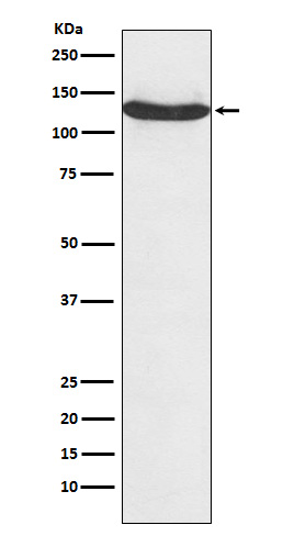 1 - Anti-hnRNP U Monoclonal Antibody ABO14631