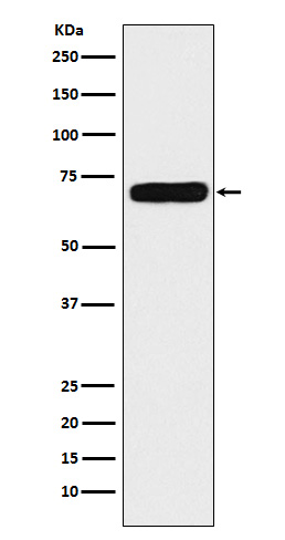 1 - Anti-NPRC Rabbit Monoclonal Antibody ABO14635