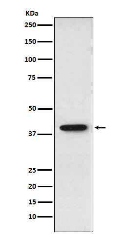 1 - Anti-SET Monoclonal Antibody ABO14637