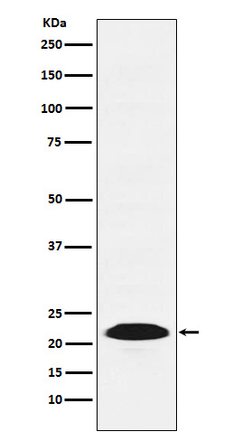 1 - Anti-PSB9 / LMP2 Rabbit Monoclonal Antibody ABO14647