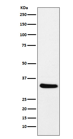 1 - Anti-CRALBP RLBP1 Monoclonal Antibody ABO14649