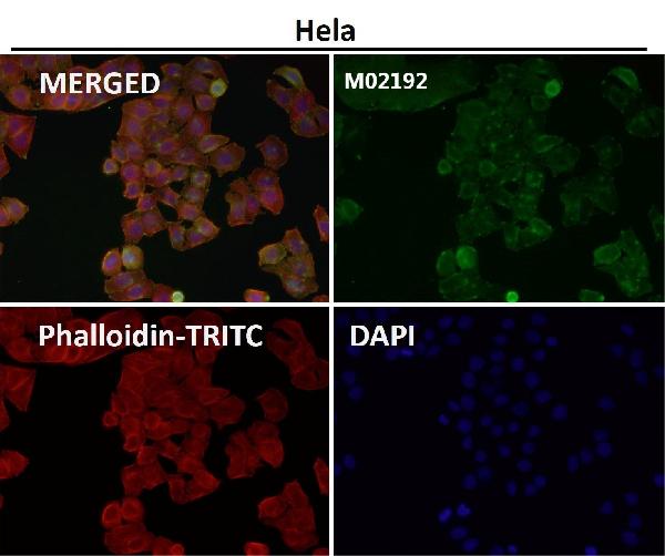 1 - Anti-Nesprin 1 Rabbit Monoclonal Antibody ABO14652