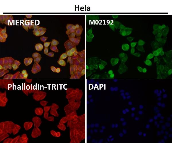 1 - Anti-Nesprin 1 Rabbit Monoclonal Antibody ABO14652