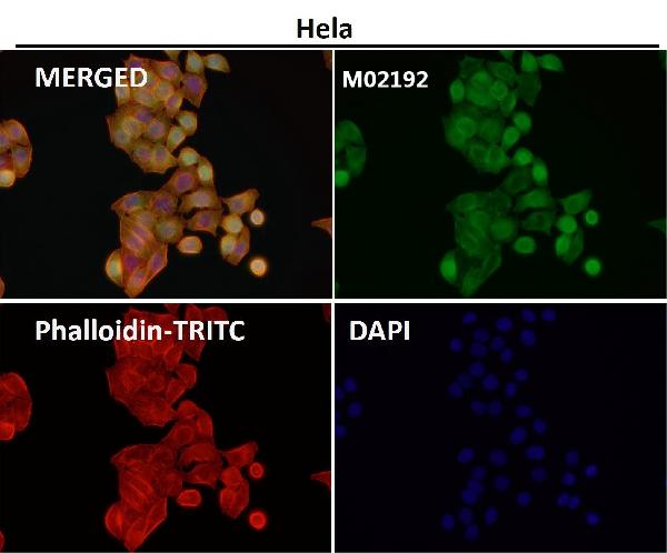 1 - Anti-Nesprin 1 Rabbit Monoclonal Antibody ABO14652