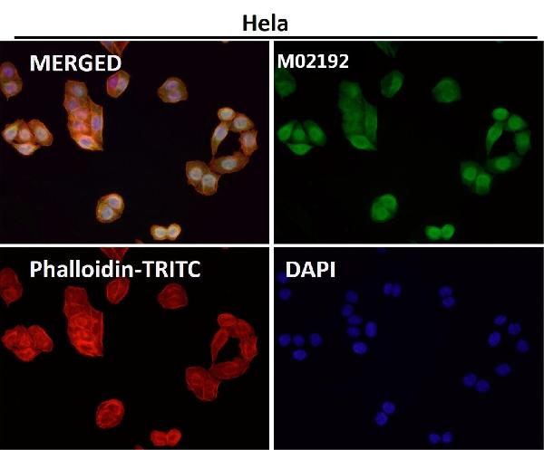 1 - Anti-Nesprin 1 Rabbit Monoclonal Antibody ABO14652